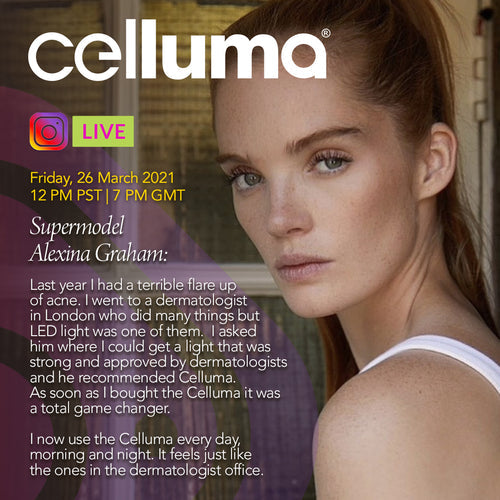 Celluma Light Therapy Acne Treatment: Alexina Graham Chooses Medical Grade LED For Home Selfcare